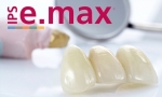   E.MAX     
